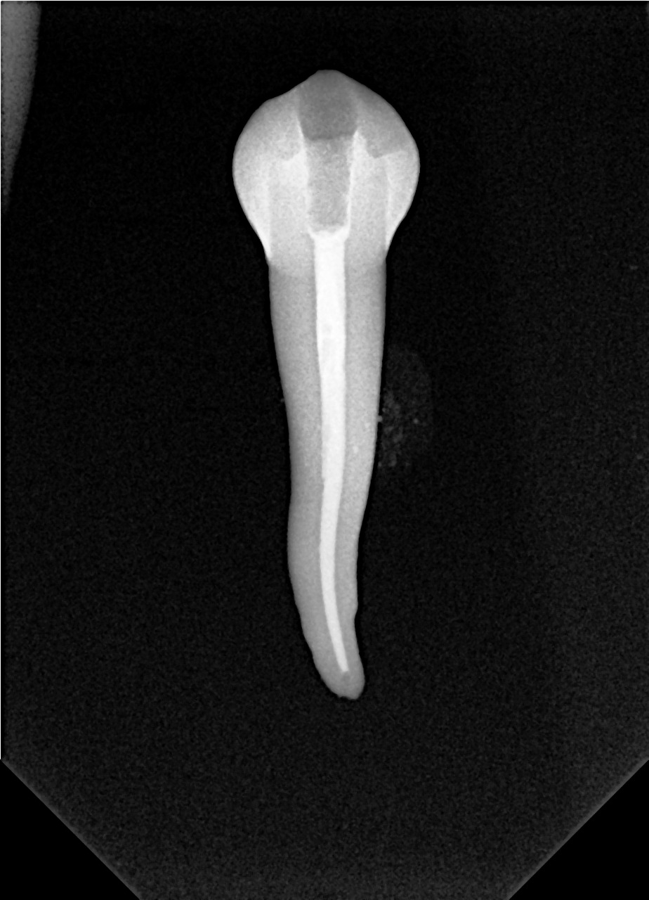 Endodoncia